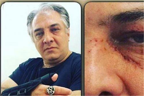 ایرج نوذری دچار سانحه شد+عکس