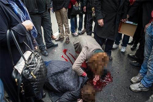  مصدوم حادثه میدان فاطمی زنده ماند 