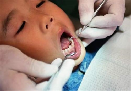 ۴ دهک اول جامعه خدمات دندانپزشکی نمی‌گیرند/دندانپزشکی تعرفه ندارد 