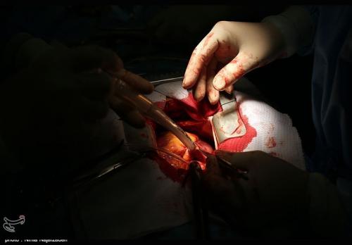 درمان ایرانی ارزانترین در جهان/تجهیزات قلب گران و دچار کمبود 