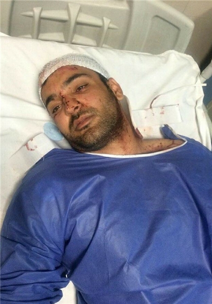 سانحه برای ملی پوش دوچرخه سواری +عکس 