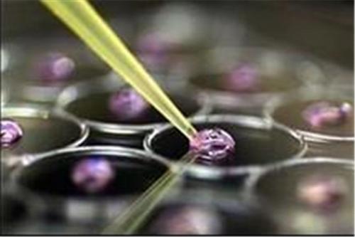 نخستین جشنواره ملی سلول‌های بنیادی و طب بازساختی برگزار می‌شود