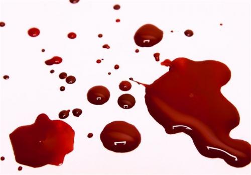  کشف جسد غرق در خون پسر جوان داخل پارک سوهانک
