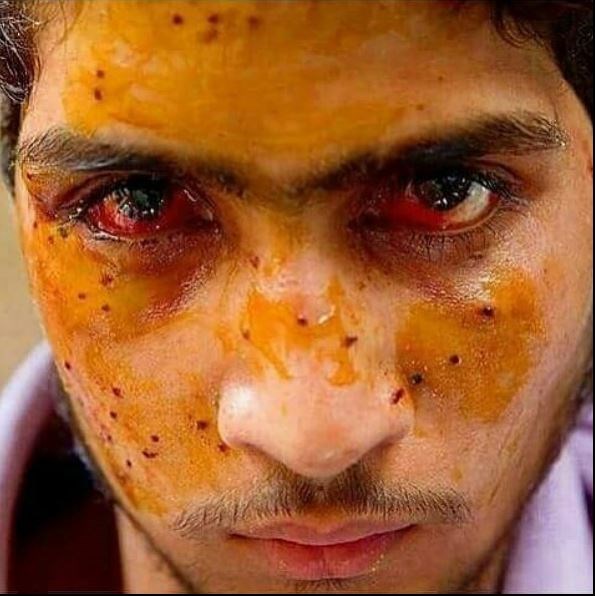  تصاویر/سرکوب اعتراضات مردمی در کشمیر 