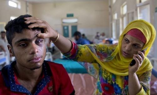 عکس: گلوله‌های ساچمه‌ای هدیه چشمان مردم کشمیر در روزهای عید