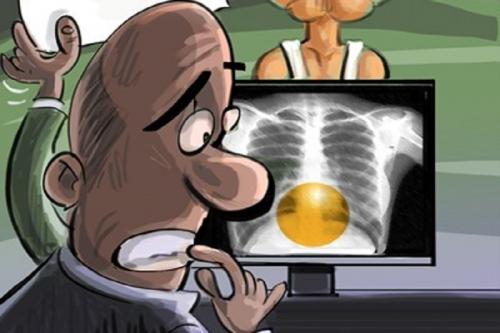 کاریکاتور/ عکس رادیولوژی مدیر عامل برکنار صندوق ذخیره 