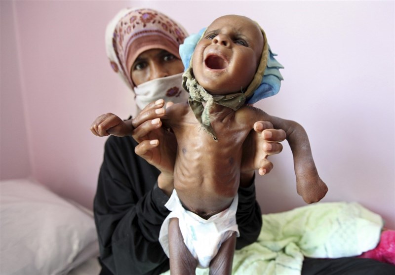  شهادت ۱۴۰۰ کودک یمنی از ابتدای تجاوز سعودی تاکنون