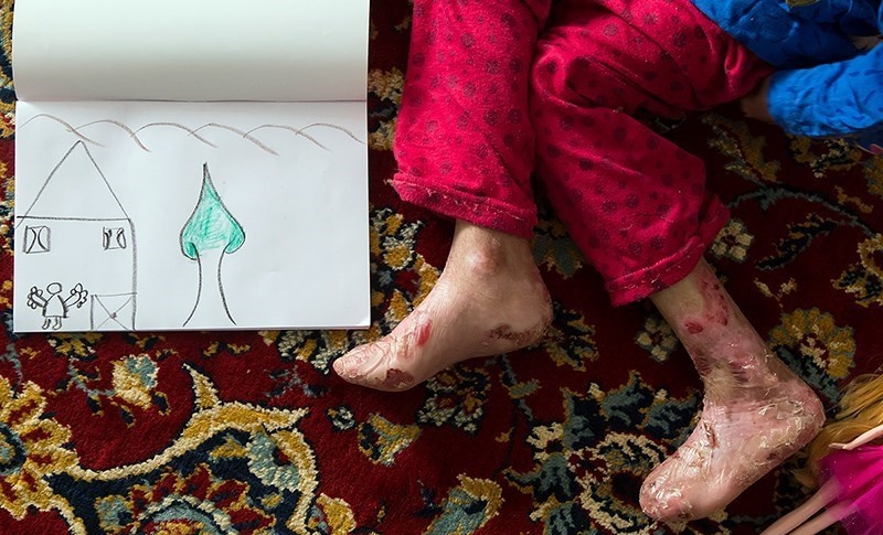 پروانه‌ای‌ها در آتش بی توجهی می‌سوزند/ برخی می‌آیند سلفی می‌گیرند و می‌روند