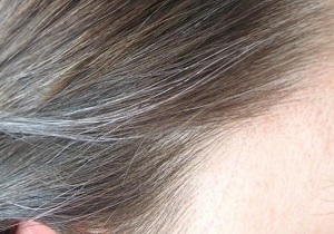 درمان ساده برای رفع سفیدی مو
