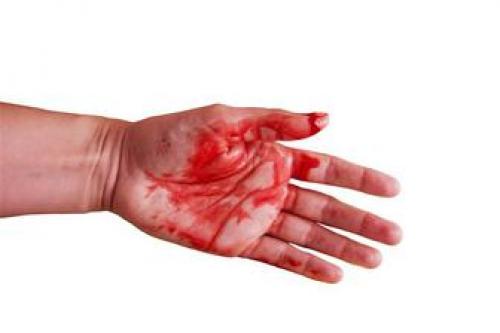 روش های جالب خانگی برای جلوگیری از خونریزی
