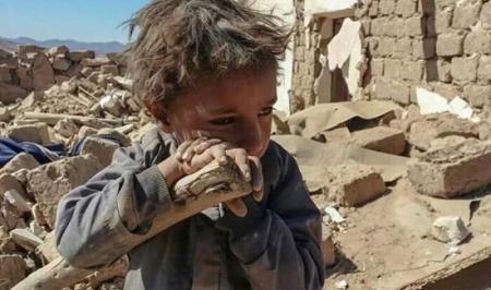 یونیسف: هفت هزار و ۳۰۰ کودک  از زمان تجاوز عربستان به یمن کشته شده‌اند 
