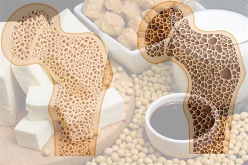 راهکار داشتن استخوان‌هایی سالم