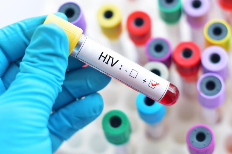 نشانه‌های اولیه HIV چیست؟