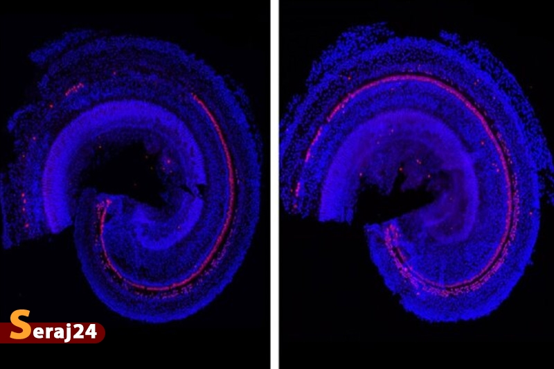 داروی جدید دانشمندان MIT برای کم‌شنوایی