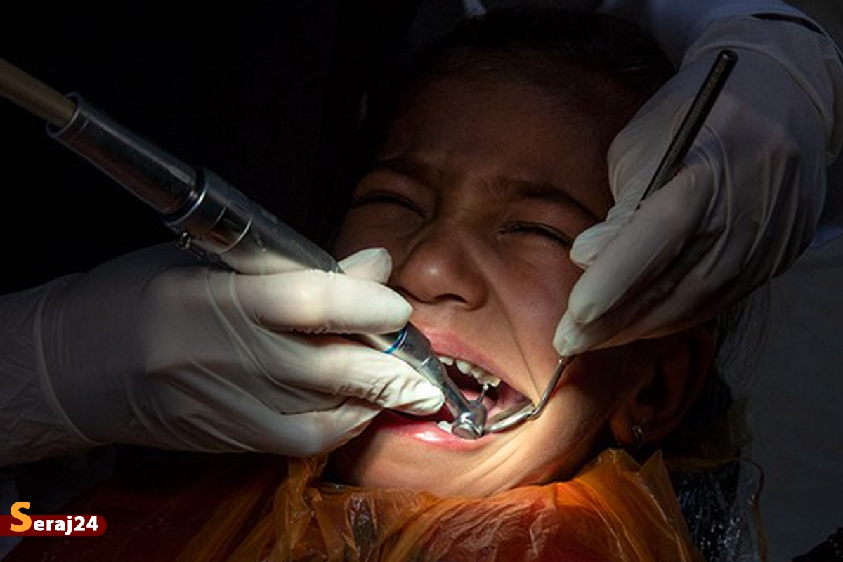 هزینه‌ درمان«دندان» گران‌تر از خرید «طلا»
