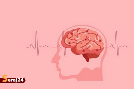روشی برای ذهن‌خوانی بیماران دچار آسیب‌های مغزی