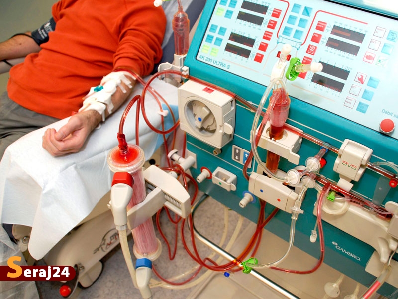 کوتاه‌تر شدن روند دیالیز با ابتکار ویژه محققان دانشگاه امیرکبیر