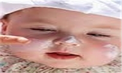 برای کودکان از ۶ ماهگی باید کرم ضدآفتاب استفاده شود