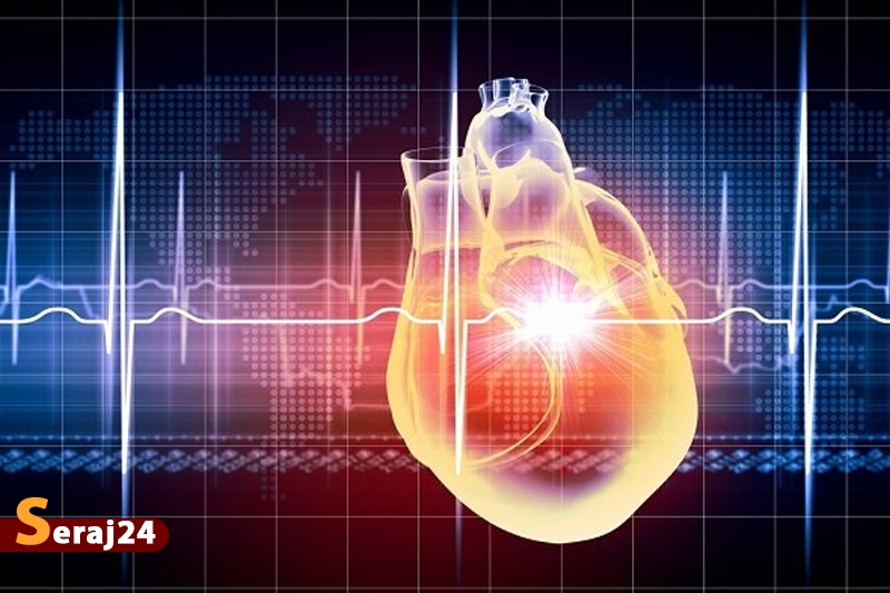 فیبریلاسیون دهلیزی ریسک زوال عقل را افزایش میدهد