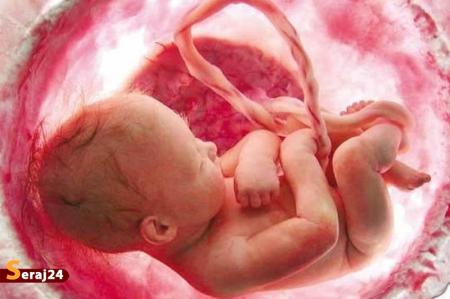 سخنگوی وزارت بهداشت: غربالگری جنین با رعایت استانداردها ممنوع نیست