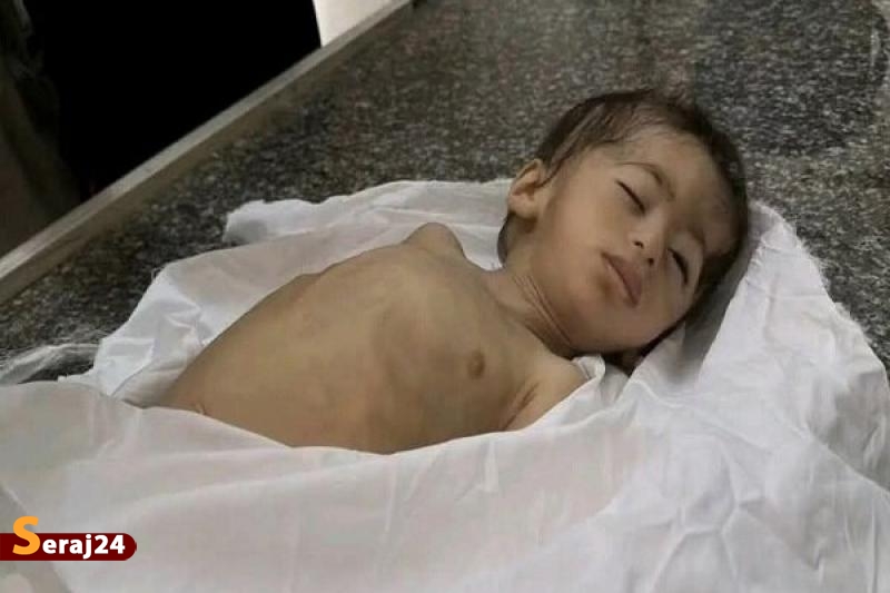 هشدار آنروا و سازمان جهانی بهداشت درباره اوضاع غزه