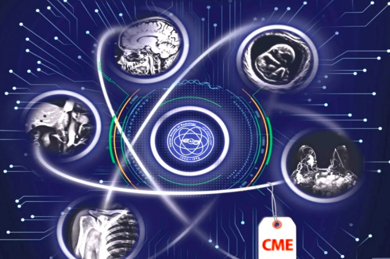 برگزاری سمینار هوش مصنوعی در حوزه‌های تخصصی رادیولوژی