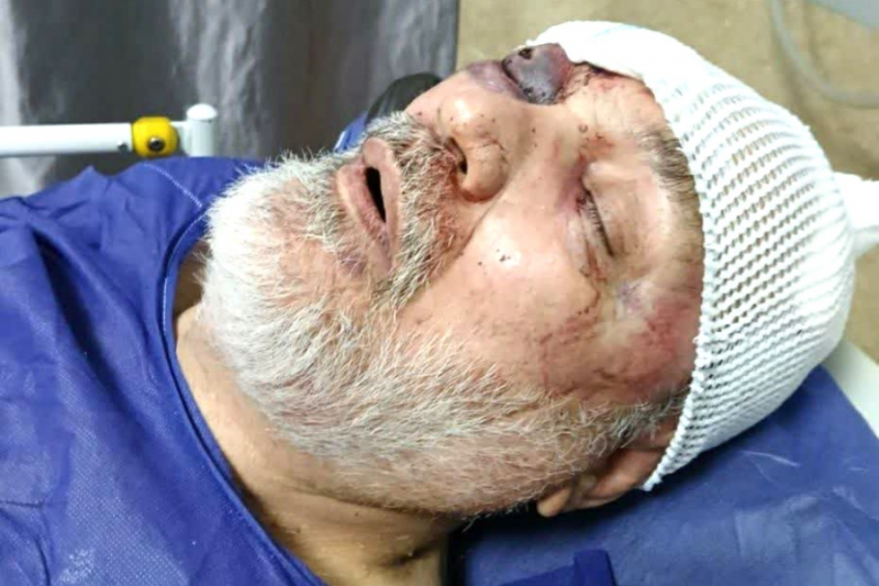 آزاده سرافراز در راه دفاع از امنیت کشور توسط آشوبگران، مجروح شد