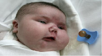 نوزادی که با تولدش مادرش را هم شوکه کرد!+عکس