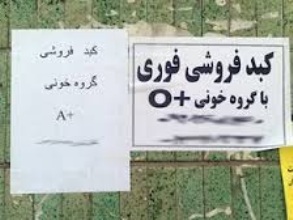 هشدار درباره خرید و فروش اینترنتی «کبد» 
