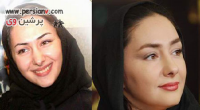 برخی بازیگران مشهور ایرانی قبل و بعد از جراحی بینی+ عکس