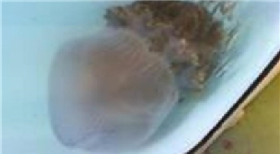 عروس دریایی مرگ آور در استرالیا+عکس