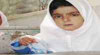 کودک پروانه‌ای کرمان، در انتظار کمک خیّرین