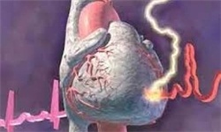 چگونه جلوی سکته قلبی را بگیریم/ چند راهکار ساده برای پیشگیری از بیماریهای قلبی