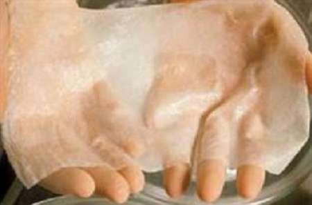 Brain-dead teenˈs skin rescues burnt Iranian girl 