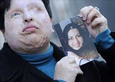 اسیدپاشی‌های مشکوک این بار در اصفهان
