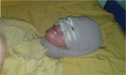 جزای پدری که روی دخترش اسید پاشید+عکس