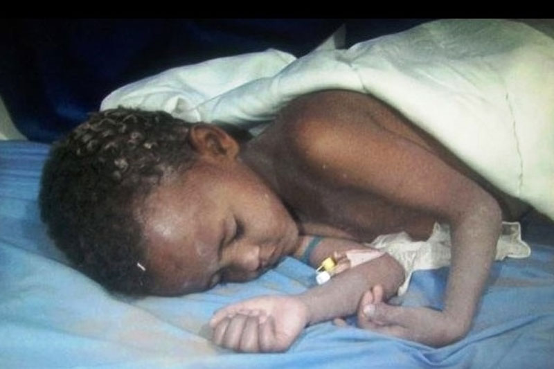 کودک کشی عربستان در یمن