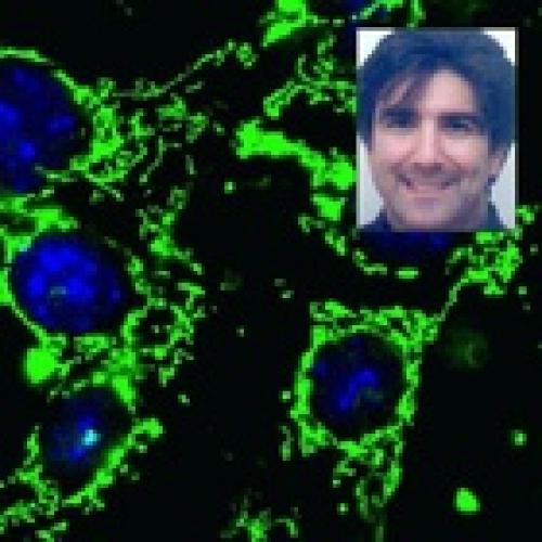 Iranian scientist finds protein likely to be key to cancer’s deadly resurgences 