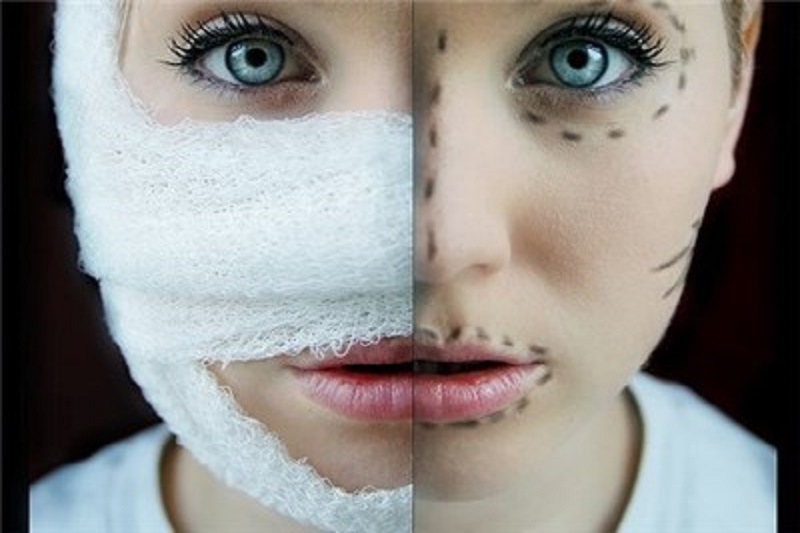تب جراحی زیبایی و آرایش بر جان جوانان ایرانی