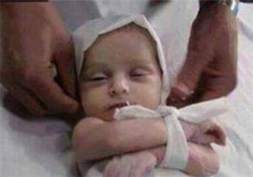 افزایش میزان مرگ و میر نوزادان شیرخوار غزه در سایه محاصره 